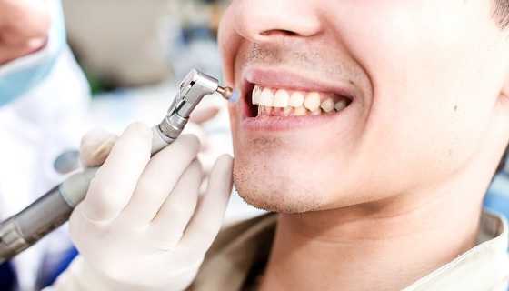 Teeth cleaning are done properly