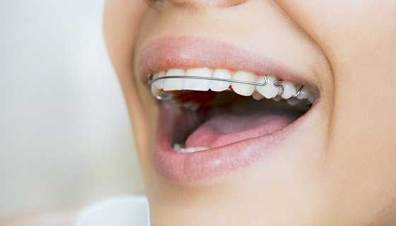 Tips For Cleaning Your Teeth When You Have A Permanent Orthodontic Retainer