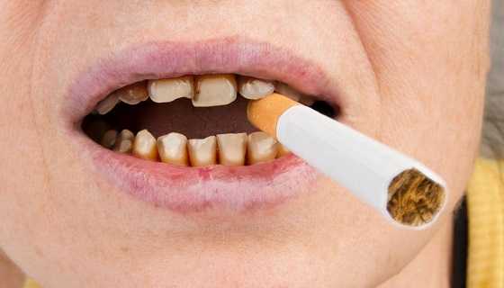 What are the effects of smoking on dental health?