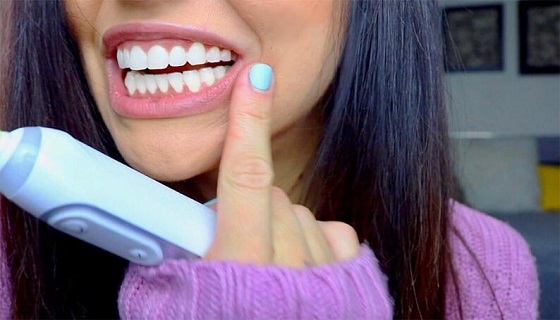 Gels and strips for teeth whitening