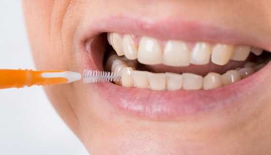 cleaning dental implants