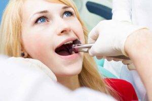 root-canal-treatment-in-pune