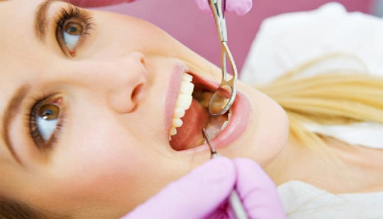  root canal treatment