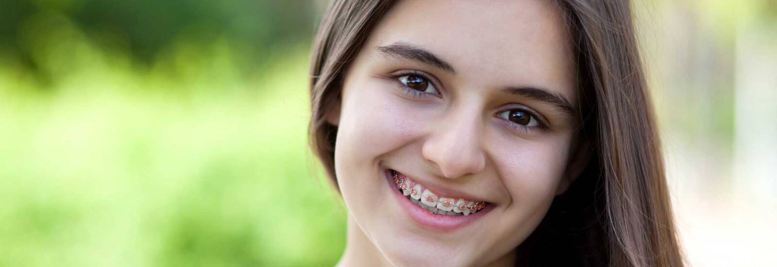 Metal Braces as An Orthodontic Treatment: A Qualified Orthodontist