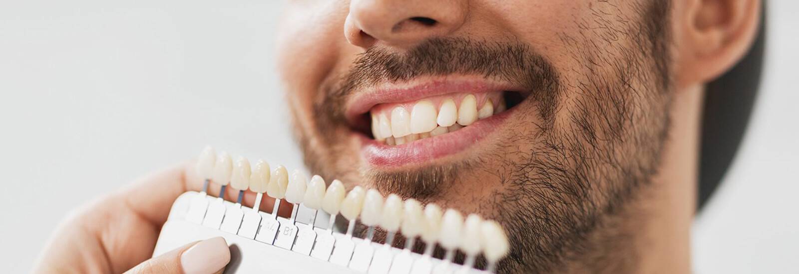 Understanding Broken Teeth Repair Cost in India