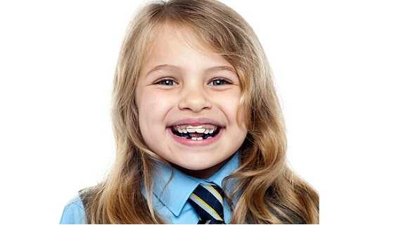 Orthodontic Problem in child