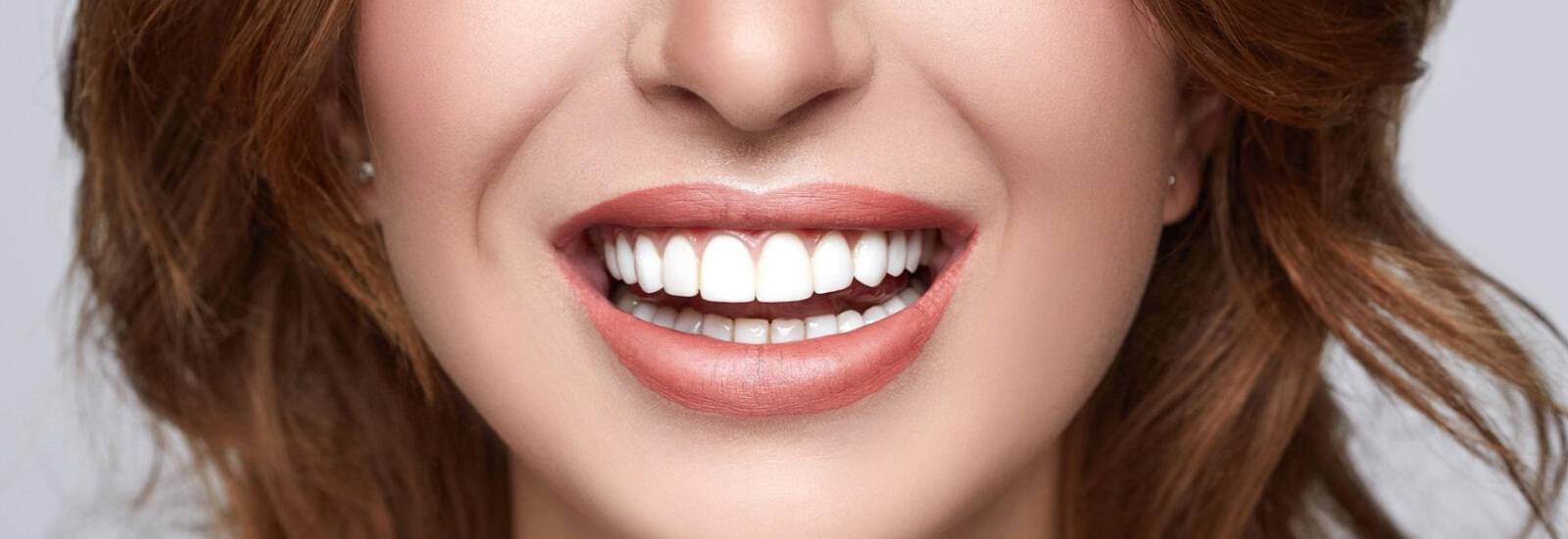 Best Smile Makeover Treatment Near Me