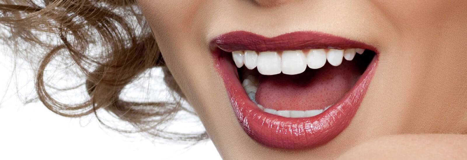 teeth-whitening-and-bleaching