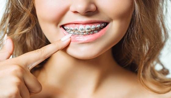 why-should-i-get-braces why-should-i-get-braces