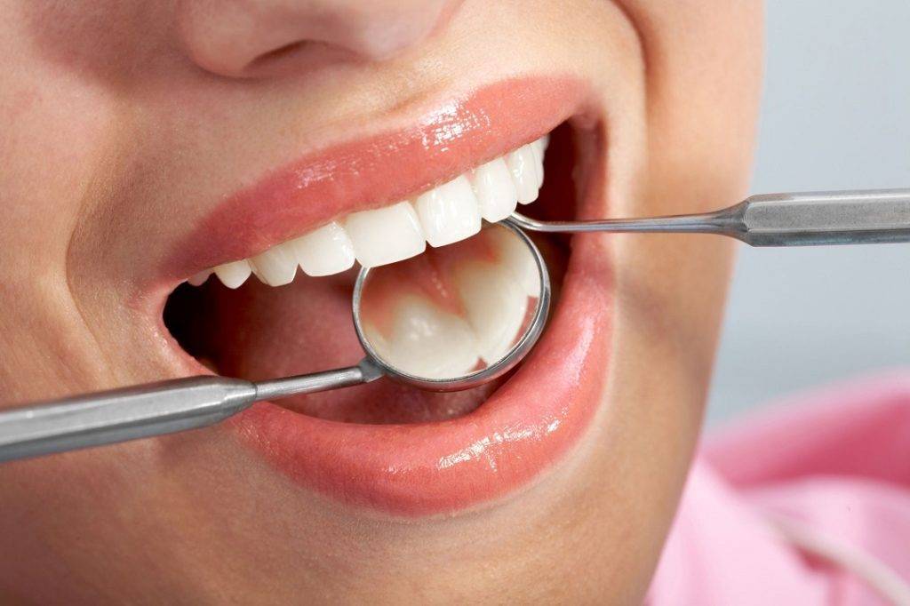 Reasons Why Dental Fillings Are Important