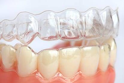 invisalign braces invisalign braces