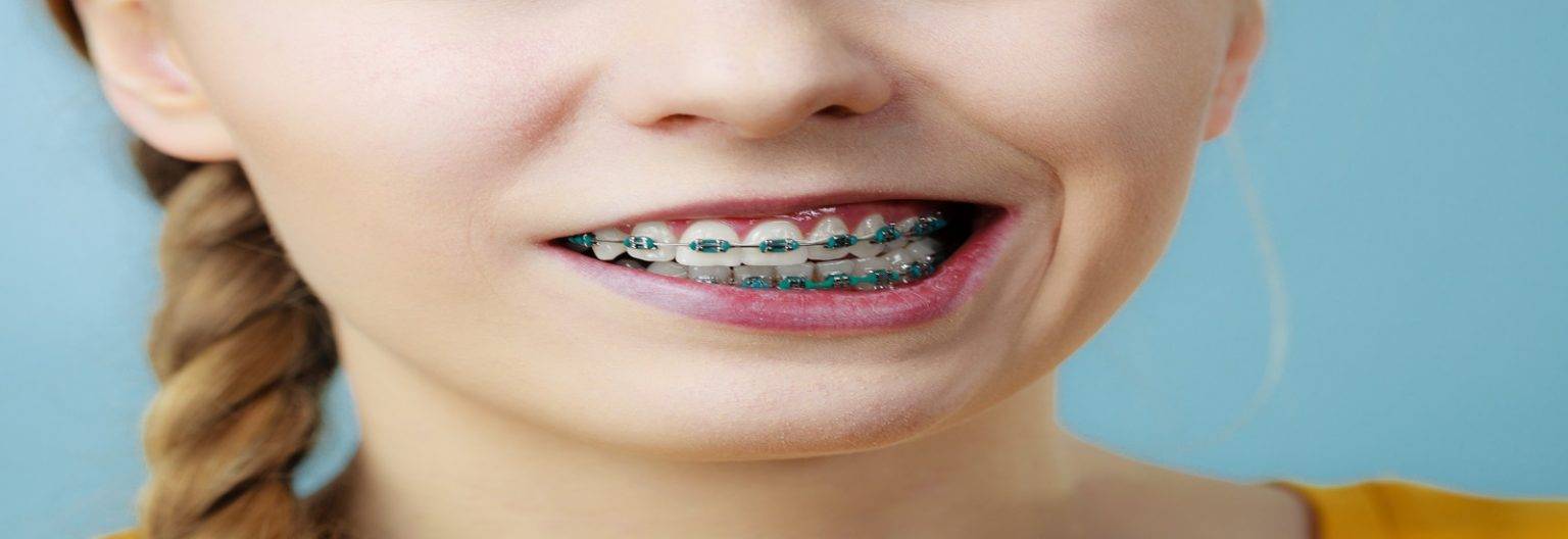 Best Orthodontist Near Me Affordable Orthodontic Treatment Cost