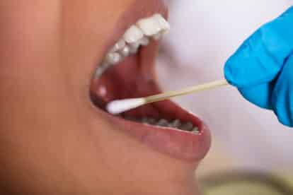 Corona affect oral health