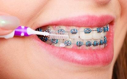 Toothbrush for misaligned teeth or braces Toothbrush for misaligned teeth or braces