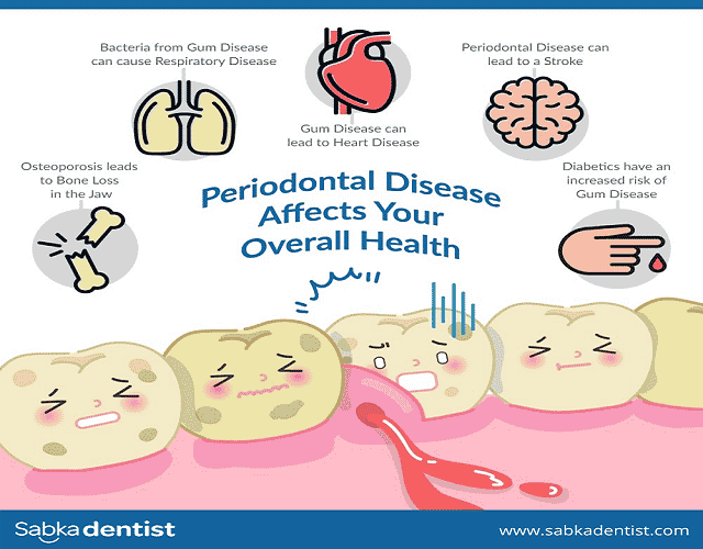 how Periodontal Disease affects overall health