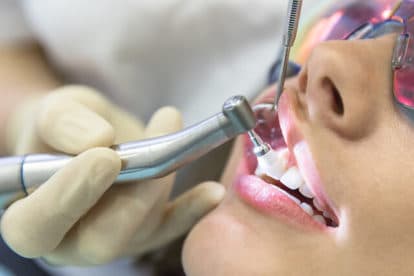 Teeth Cleaning in Bangalore