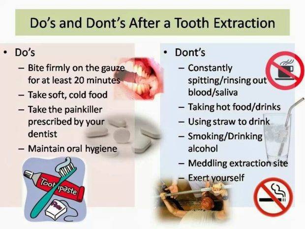 tooth-extraction-cost-in-india-dental-extraction-treatment-in-india