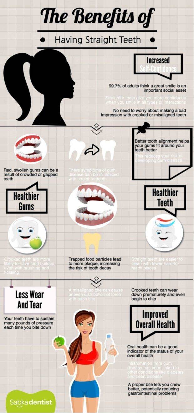 benefits of correct teeth alignment and braces