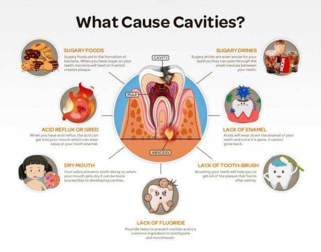causes of dental cavities