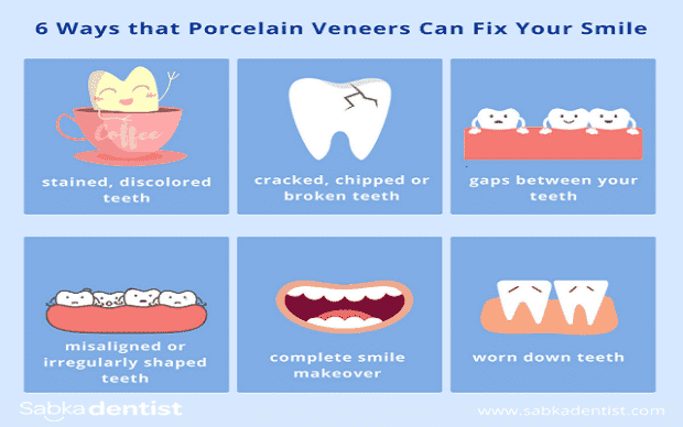 How do you take care of veneers