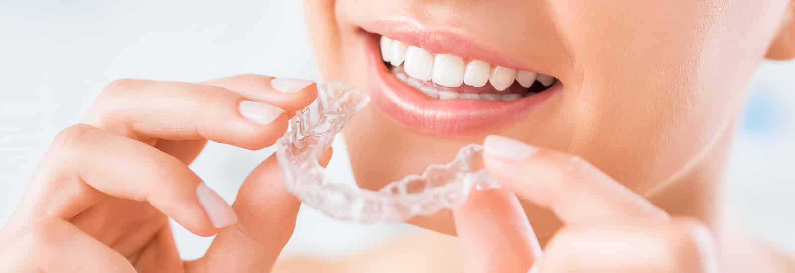 Clear Aligners Invisible Braces