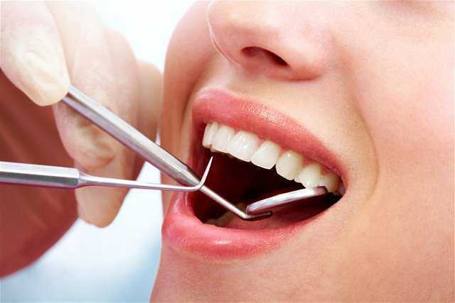 cost of teeth filling