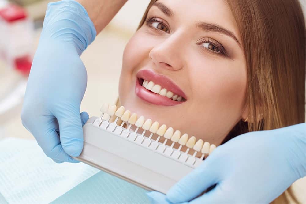 Reasons to Consider Professional Teeth Whitening