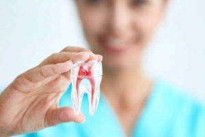 root-canal-treatment-specialist