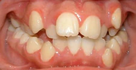 दातांची संरचना