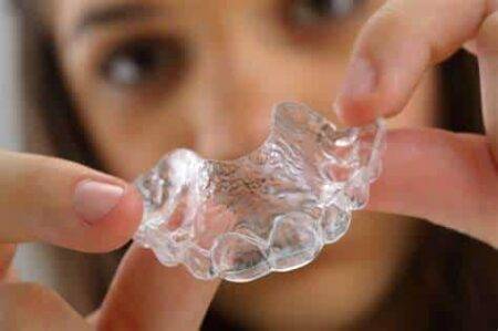 removable aligners