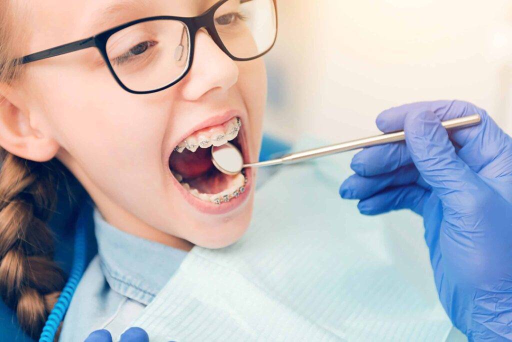 How to take care of braces