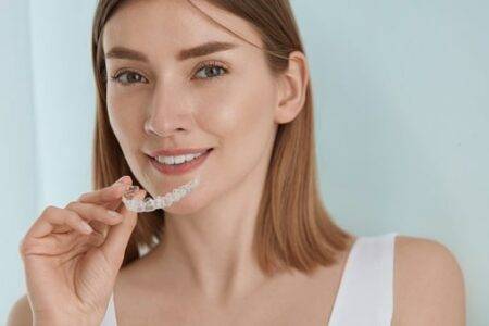 clear aligners