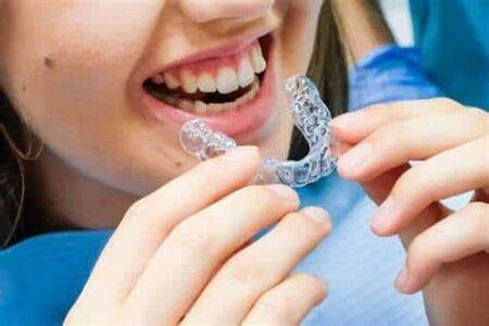 retainers