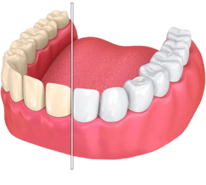 Dental Clinic in Nigdi Pune