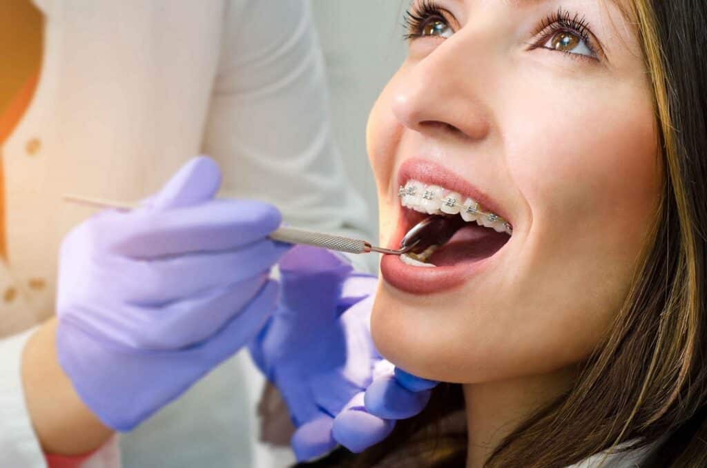 What Are Different Types Of Braces Treatment Options