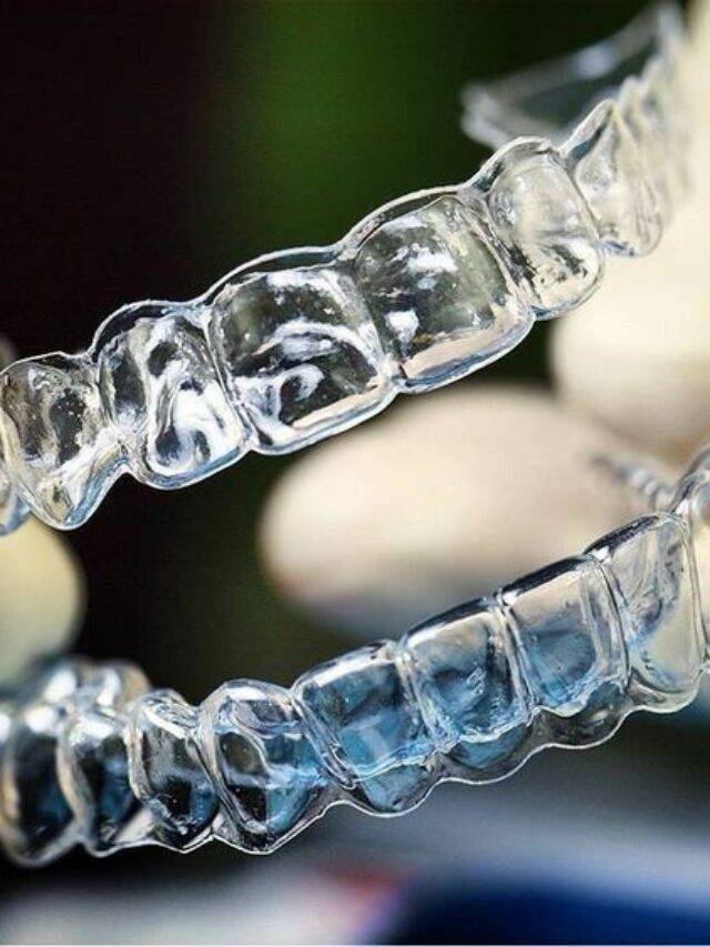 How To Use SDalign Clear Aligners? Sabka Dentist Top Dental Clinic