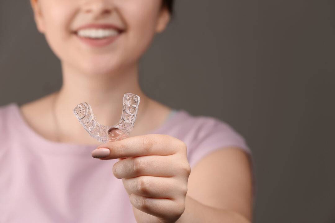 Clear Aligners Are the Preferred Choice for Adult Orthodontics
