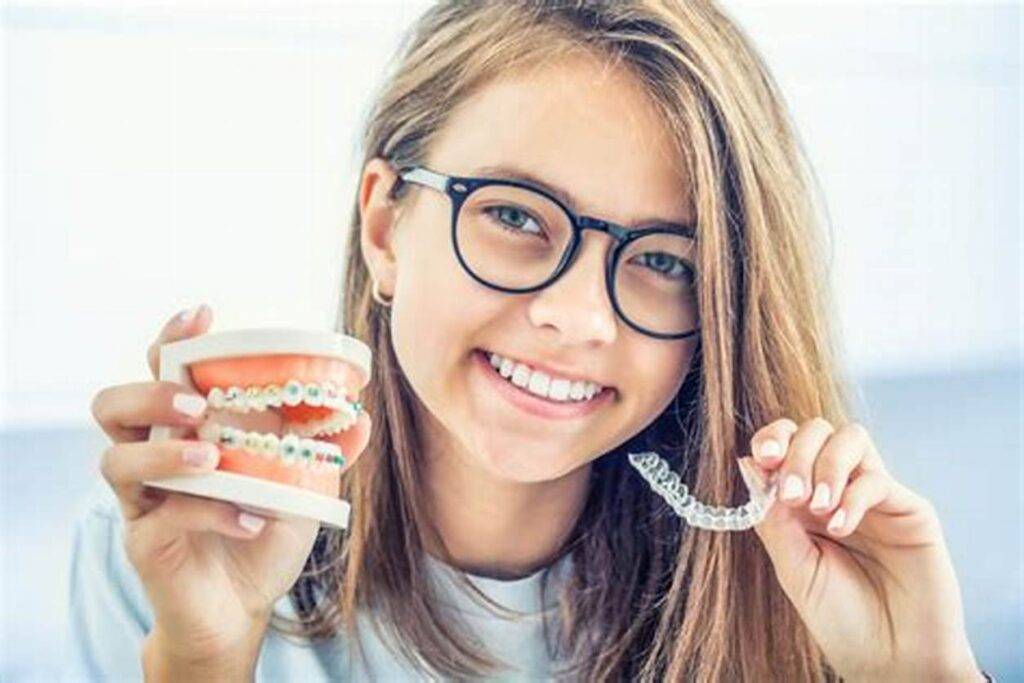 Clear Aligners vs. Traditional Braces