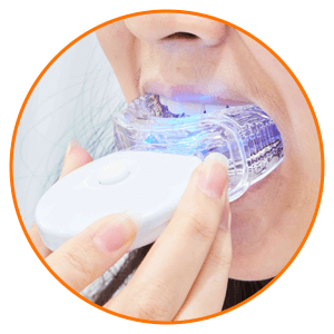 At-Home-Whitening-Kits
