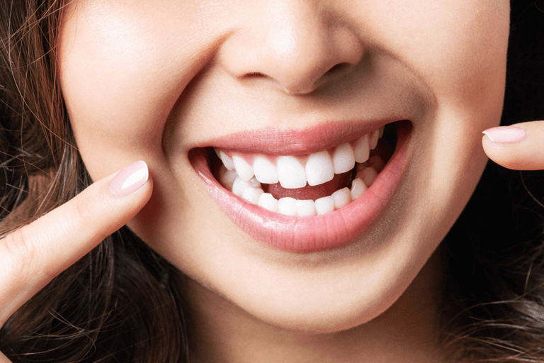 how-to-whiten-teeth-after-braces-aligners