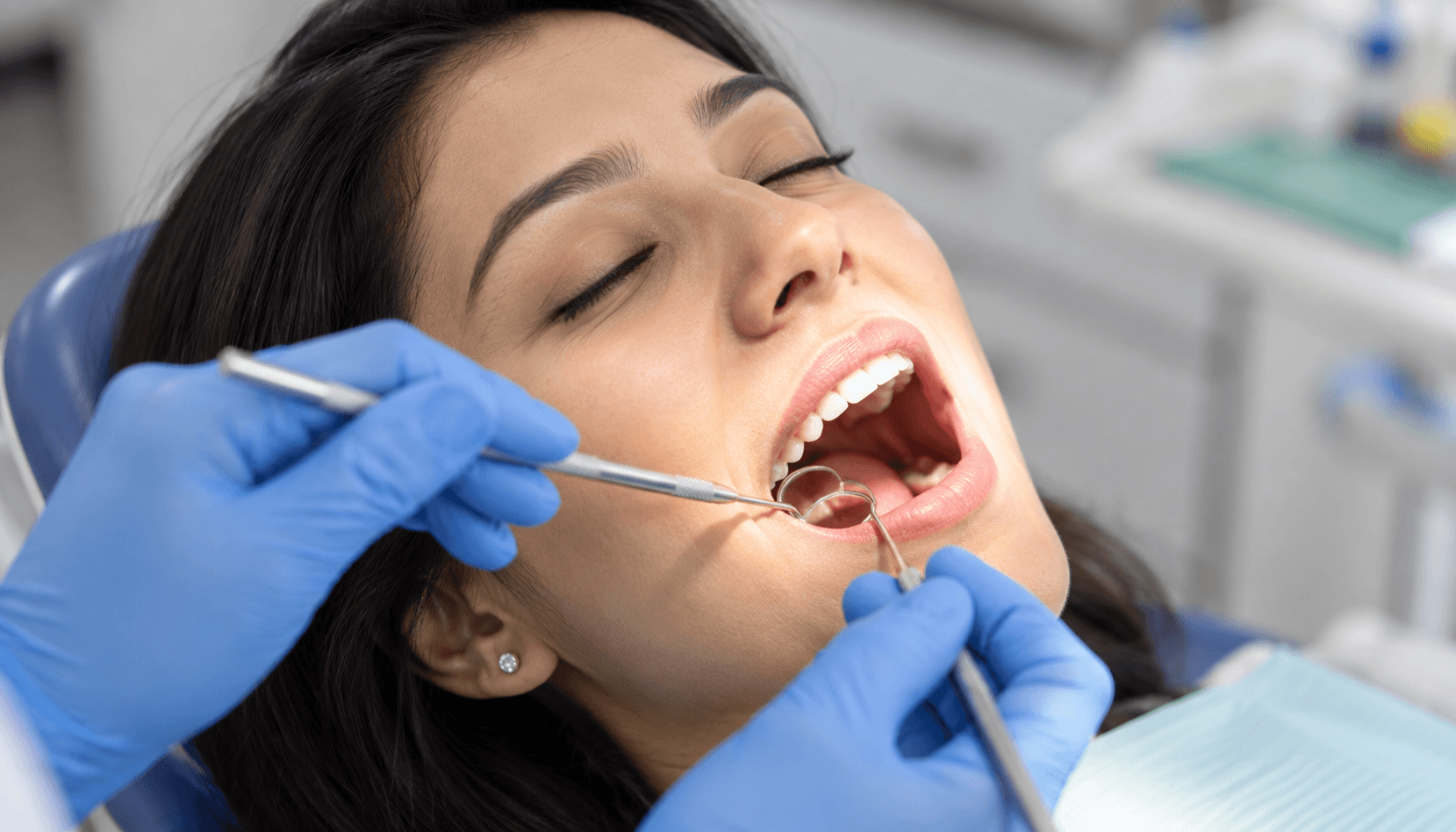 Extractions and fillings