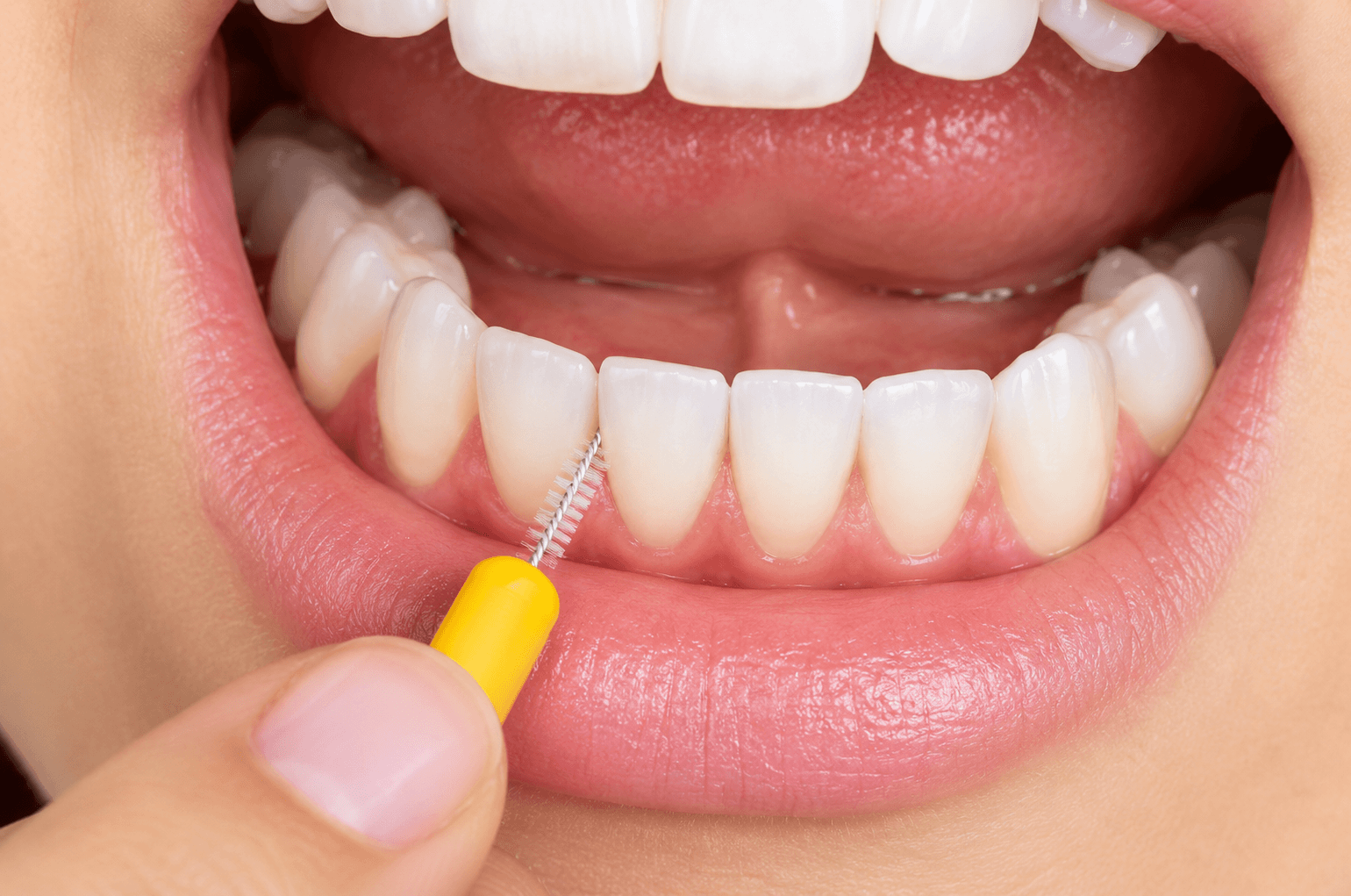 Interdental_brush