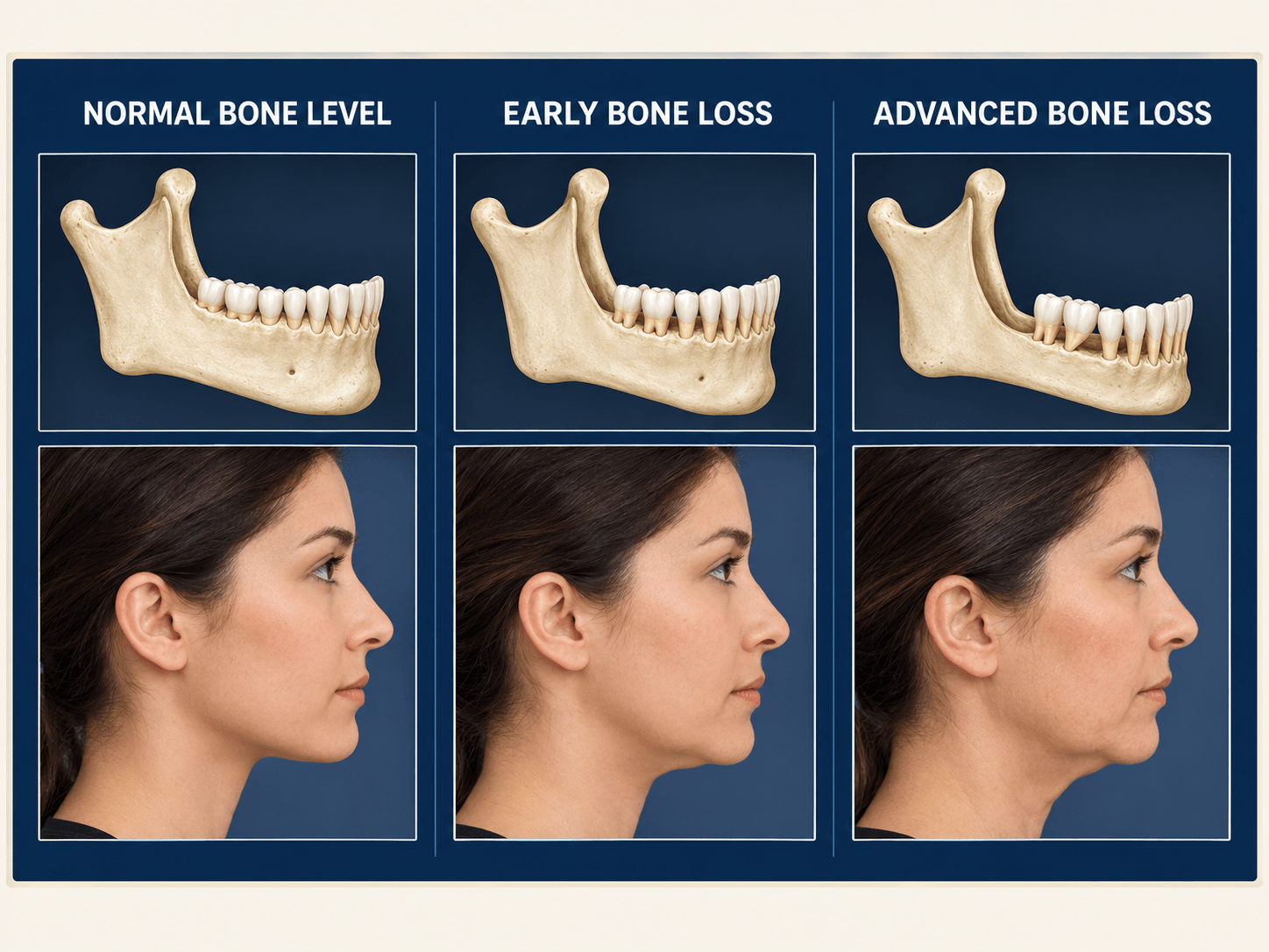 missing teeth problems